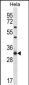 RPL7 Antibody (N-term)